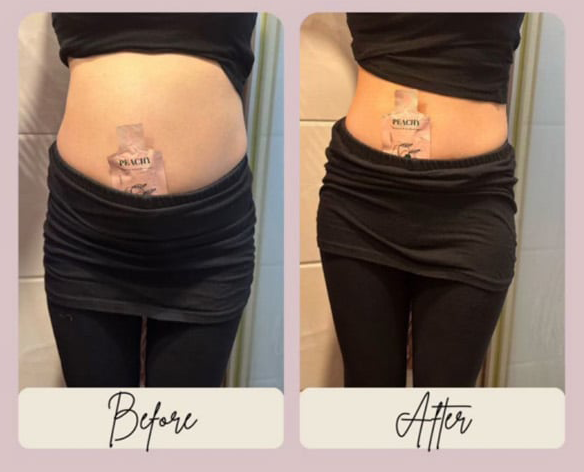 Before and after waistline comparison featuring Peachy Peach Probiotic Enzyme at Grandmama Store in Hong Kong